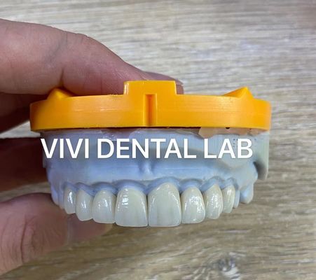 La lamina de Ivoclar Emax chapea el laboratorio dental de alto nivel profesional translúcido de China