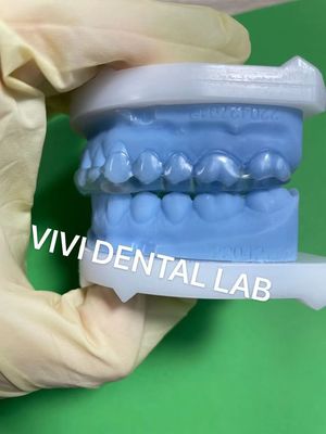 Dentista estable tipo Michigan Espintilla Semi dura / dura ajuste perfecto
