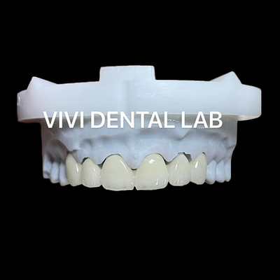 Coroa y puente de zirconia translucidez 3D PRO