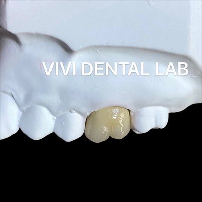Las coronas de porcelana de metal libre Be Ni PFM Crown China Dental Lab