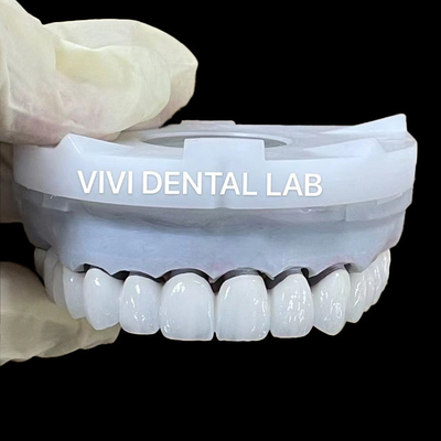 Las coronas de laboratorio dentales de zirconia súper blanca 3D PRO PFZ Noritake porcelana