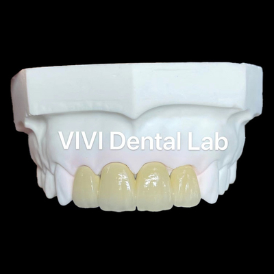 Coroas de zirconio PFZ Coroa de porcelana de zirconio Coroa dental de dientes