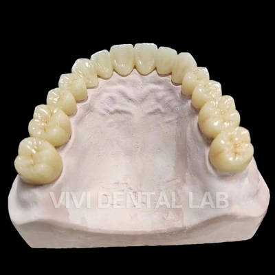 Puente completo dental Puente total profesional Puente completo
