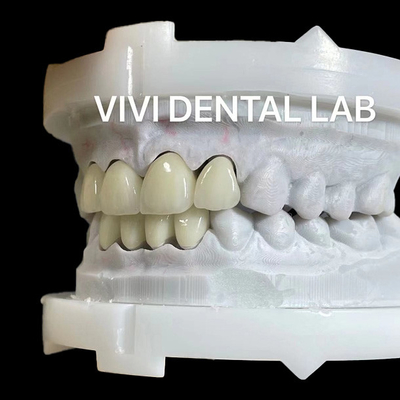 Corona y puente de zirconia de fuerte capa en buena estética