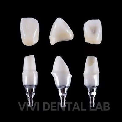 Implante dental Tibase Abutment de zirconia Titanio Precisión personalizada