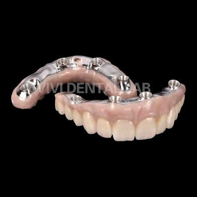 Corona de implante dental de zirconio biocompatible con barra de titanio