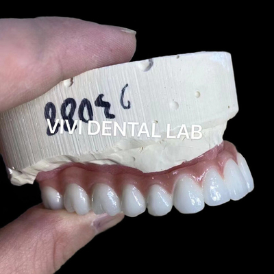 Espoil natural de aspecto estético retenido de zirconio Implante de corona duradera