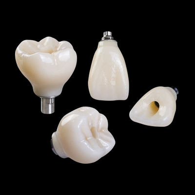 Implante dental de zirconio profesional corona de titanio CAD CAM