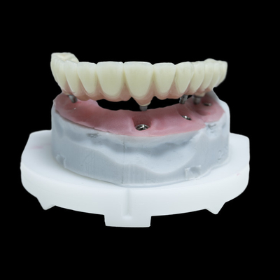 Todos en 4 PFM Implante dental corona de titanio zirconia Todos en 6 restauraciones