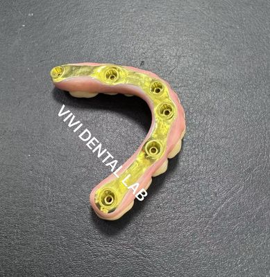 Puente de zirconio completo con soporte de barra de titanio Laboratorio dental de China