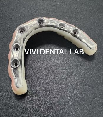 Puente estético de zirconio completo con barra de titanio atornillada retenido del laboratorio dental de China