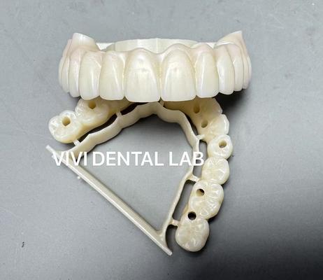 Puente completo de zirconia atornillado Laboratorio dental de China