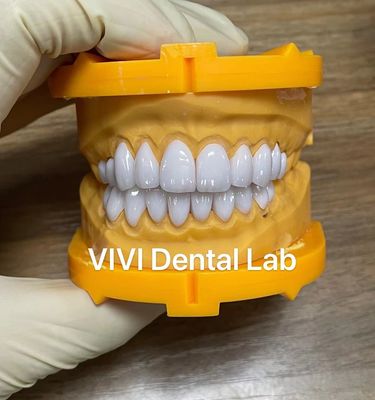 La lamina de Ivoclar Emax chapea el laboratorio dental de China de la alta translucidez