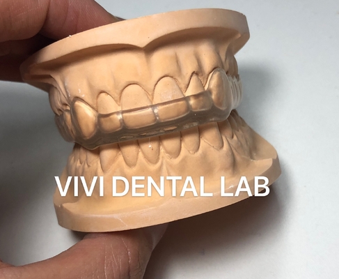 Protector bucal dental nocturno oclusal de la férula Ekodent buen ajuste alta estética