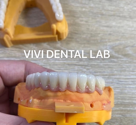 Dental de mandíbula completa Circonia Puente Implante de corona Translucidez Estética