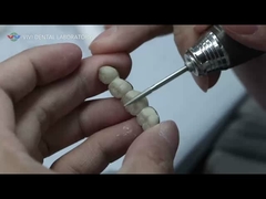 Puente de cerámica de metal