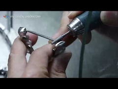 Coroas y puentes PFM