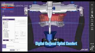 Férula oclusal digital Comodidad precisa