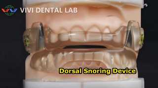 Dispositivo dental anti ronquidos