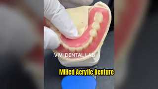Dentadura postiza acrílica fresada de alta calidad