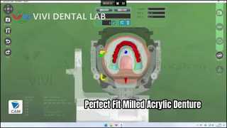 Dentadura postiza acrílica fresada Digital de ajuste superior