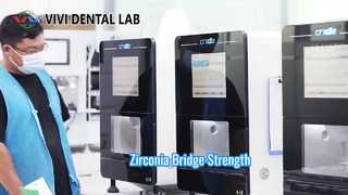 Puente de circonio Fuerte estética VIVI Dental Lab